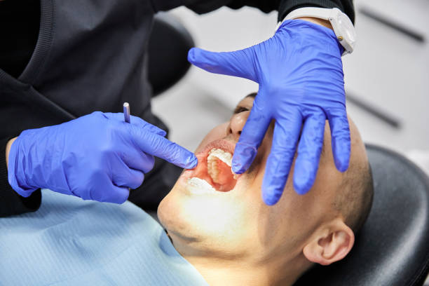 Best Knocked-Out Tooth (Avulsed Tooth) Treatment in Edina, MN